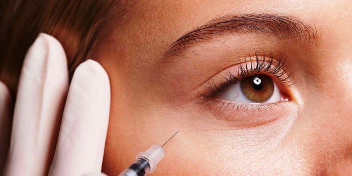 The Facts and Fiction of Botox