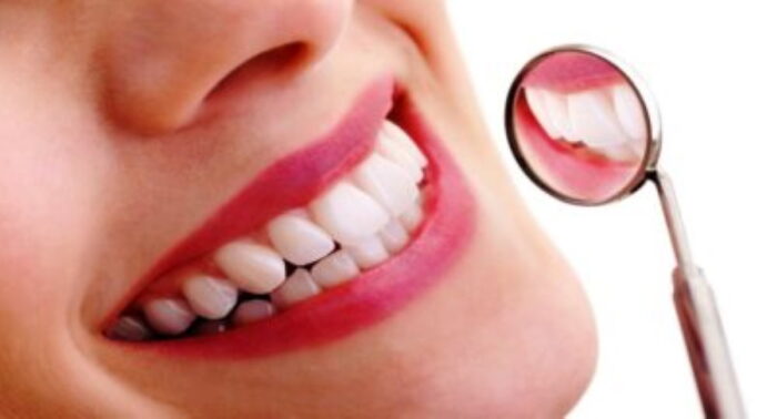 4 Simple Steps to Maximum Dental Health